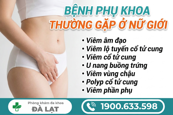Hình ảnh minh họa